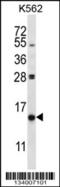 Phosphoinositide-3-Kinase Interacting Protein 1 antibody, 57-275, ProSci, Western Blot image 