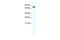 CBFA2/RUNX1 Partner Transcriptional Co-Repressor 2 antibody, GTX44661, GeneTex, Western Blot image 