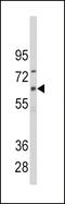 Cytochrome P450 1B1 antibody, 63-271, ProSci, Western Blot image 