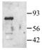 P21 (RAC1) Activated Kinase 1 antibody, GTX22551, GeneTex, Western Blot image 