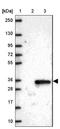 Transmembrane Protein 38A antibody, NBP2-13452, Novus Biologicals, Immunohistochemistry frozen image 