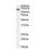 Calcium Voltage-Gated Channel Auxiliary Subunit Alpha2delta 1 antibody, NB100-60951, Novus Biologicals, Western Blot image 