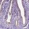 AP-5 complex subunit beta-1 antibody, HPA065739, Atlas Antibodies, Immunohistochemistry paraffin image 