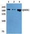 Glutamine And Serine Rich 1 antibody, PA5-37166, Invitrogen Antibodies, Western Blot image 