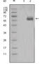 Dickkopf WNT Signaling Pathway Inhibitor 1 antibody, STJ98000, St John