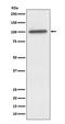 Actinin Alpha 4 antibody, M01975, Boster Biological Technology, Western Blot image 