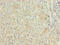 Fatty Acid Binding Protein 1 antibody, CSB-PA007940YA01HU, Cusabio, Immunohistochemistry frozen image 