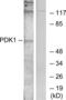 3-phosphoinositide-dependent protein kinase 1 antibody, LS-C118223, Lifespan Biosciences, Western Blot image 