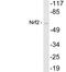 Nuclear Factor, Erythroid 2 Like 2 antibody, LS-C199950, Lifespan Biosciences, Western Blot image 