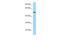 SAS-6 Centriolar Assembly Protein antibody, A05762, Boster Biological Technology, Western Blot image 