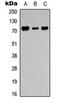 DEAD-Box Helicase 3 Y-Linked antibody, LS-C355991, Lifespan Biosciences, Western Blot image 