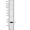 Protein Phosphatase 3 Regulatory Subunit B, Alpha antibody, abx217914, Abbexa, Western Blot image 