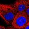 Inositol Polyphosphate-4-Phosphatase Type II B antibody, NBP1-85883, Novus Biologicals, Immunofluorescence image 