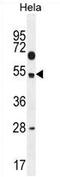 TSPY Like 6 antibody, AP54387PU-N, Origene, Western Blot image 