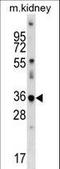 Cyclin Dependent Kinase Like 4 antibody, LS-C164341, Lifespan Biosciences, Western Blot image 