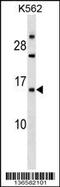 Epithelial Membrane Protein 1 antibody, 59-175, ProSci, Western Blot image 