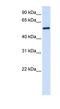 5'-Aminolevulinate Synthase 2 antibody, NBP1-54727, Novus Biologicals, Western Blot image 