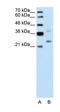 Defective In Cullin Neddylation 1 Domain Containing 1 antibody, orb330245, Biorbyt, Western Blot image 