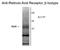 Retinoic acid receptor beta antibody, GTX30168, GeneTex, Western Blot image 