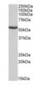 Aldehyde Dehydrogenase 6 Family Member A1 antibody, orb125069, Biorbyt, Western Blot image 