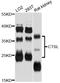 Cathepsin L antibody, abx125735, Abbexa, Western Blot image 