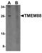 Transmembrane Protein 88 antibody, PA5-21164, Invitrogen Antibodies, Western Blot image 