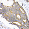 Matrix Metallopeptidase 11 antibody, A3034, ABclonal Technology, Immunohistochemistry paraffin image 