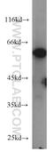 Extracellular Matrix Protein 1 antibody, 66023-1-Ig, Proteintech Group, Western Blot image 