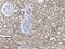 APC Membrane Recruitment Protein 1 antibody, 55432-1-AP, Proteintech Group, Immunohistochemistry paraffin image 