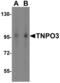 Transportin 3 antibody, NBP1-76374, Novus Biologicals, Western Blot image 
