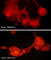 SHC Adaptor Protein 1 antibody, SM3531, ECM Biosciences, Immunocytochemistry image 
