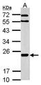  antibody, GTX116151, GeneTex, Western Blot image 