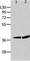 Matrix Metallopeptidase 11 antibody, orb107554, Biorbyt, Western Blot image 