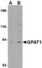 Glycerol-3-Phosphate Acyltransferase, Mitochondrial antibody, LS-B2734, Lifespan Biosciences, Western Blot image 
