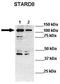 StAR Related Lipid Transfer Domain Containing 8 antibody, TA342687, Origene, Western Blot image 