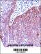 Keratin 6B antibody, 57-231, ProSci, Immunohistochemistry frozen image 