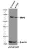 Tripeptidyl Peptidase 2 antibody, 66017-1-Ig, Proteintech Group, Western Blot image 