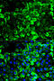 Tropomyosin 1 antibody, 14-051, ProSci, Immunofluorescence image 