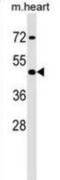 Homeobox A2 antibody, abx029393, Abbexa, Western Blot image 