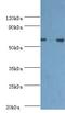 3-phosphoinositide-dependent protein kinase 1 antibody, LS-C376300, Lifespan Biosciences, Western Blot image 