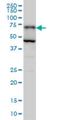 Phosphoglucomutase-2 antibody, H00055276-M05, Novus Biologicals, Western Blot image 