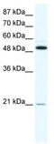 TNF Receptor Superfamily Member 11b antibody, TA330320, Origene, Western Blot image 