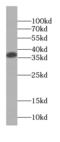 Small Glutamine Rich Tetratricopeptide Repeat Containing Alpha antibody, FNab07817, FineTest, Western Blot image 