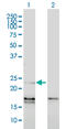 Endothelin 1 antibody, LS-C197103, Lifespan Biosciences, Western Blot image 