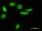 Low Density Lipoprotein Receptor Adaptor Protein 1 antibody, H00026119-M01, Novus Biologicals, Immunocytochemistry image 