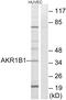 Aldose reductase antibody, OAAF03258, Aviva Systems Biology, Western Blot image 