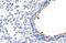 Zinc Finger Protein 16 antibody, PA5-41520, Invitrogen Antibodies, Immunohistochemistry paraffin image 