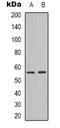 Melan-A antibody, orb388113, Biorbyt, Western Blot image 