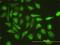 Ubiquitin Conjugating Enzyme E2 G1 antibody, H00007326-M01, Novus Biologicals, Immunofluorescence image 