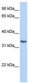 RAB40A, Member RAS Oncogene Family antibody, TA340254, Origene, Western Blot image 